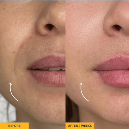 Lymphatic Contour Face Brush™