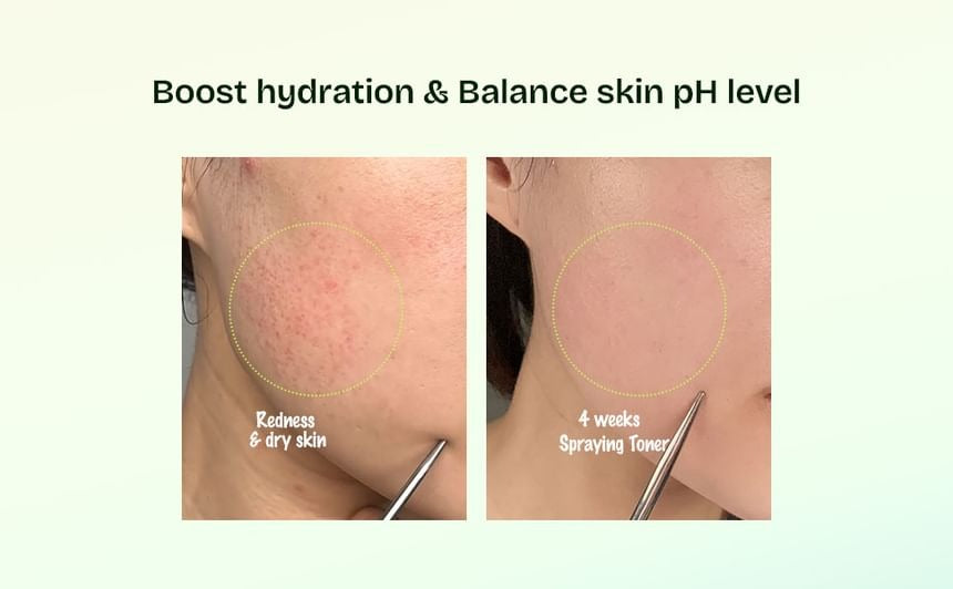Orien - Mugwort Soothe In Toner