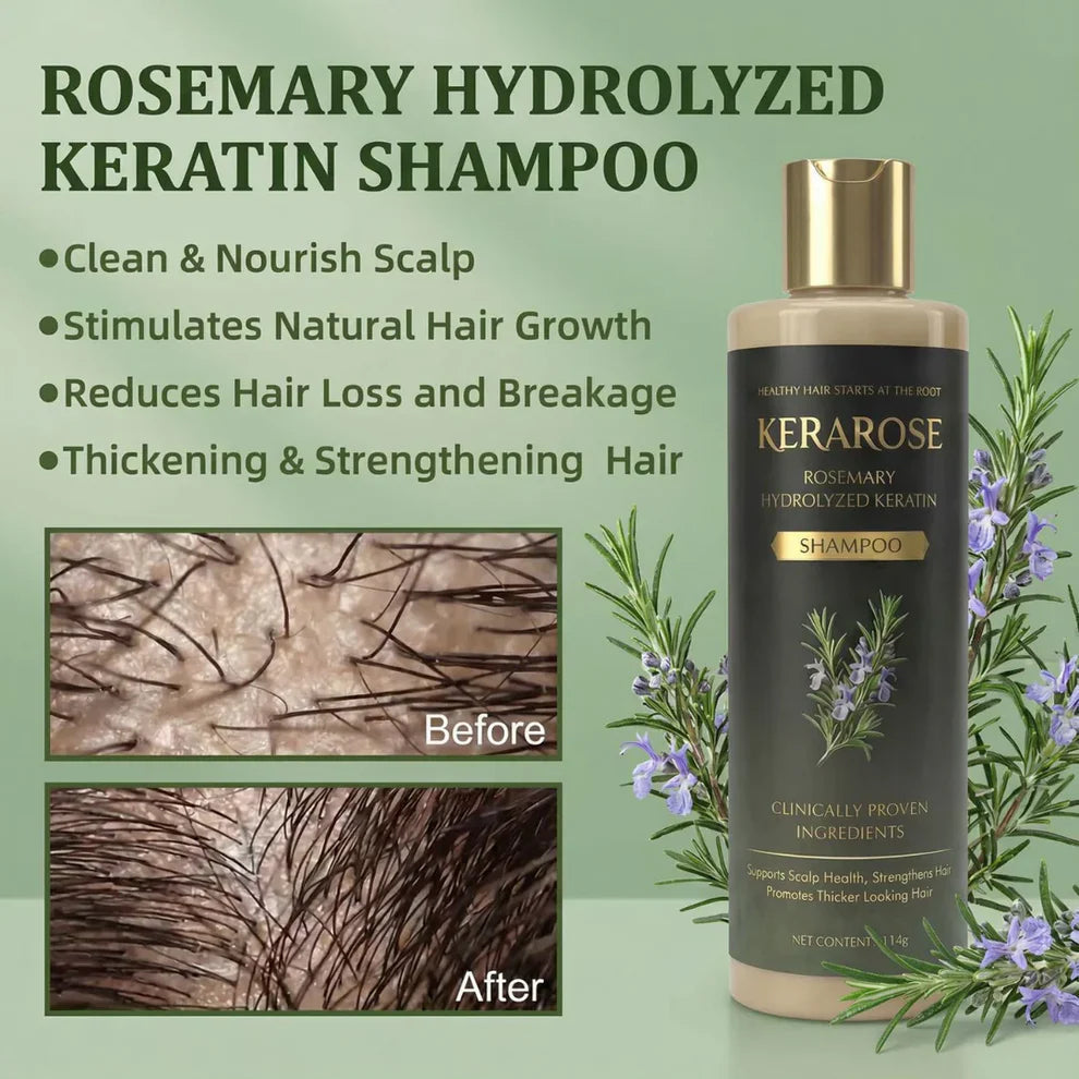 Kerarose Rosemary Shampoo For Hair Growth ( Buy 1 Get 1 Free 🔥) .