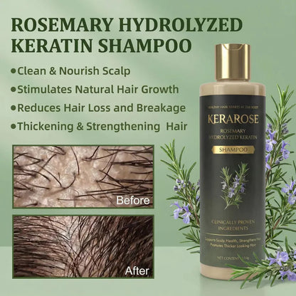 Kerarose Rosemary Shampoo For Hair Growth...