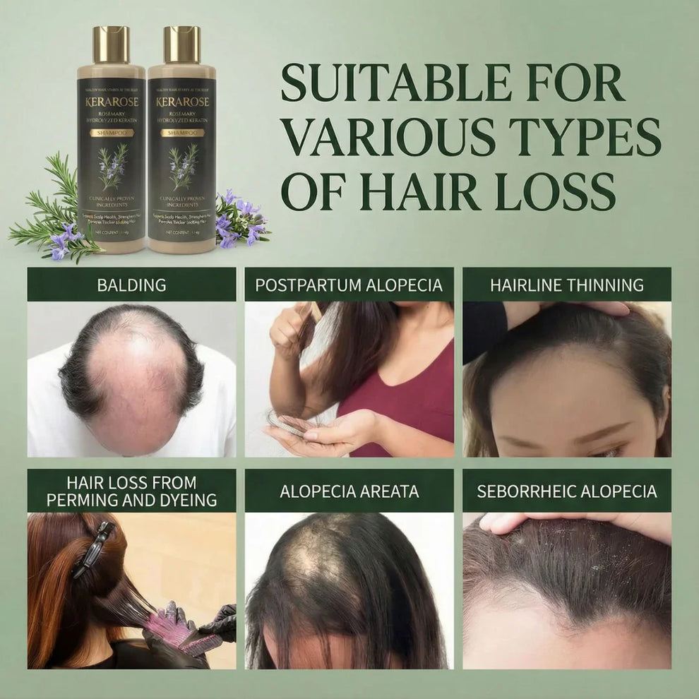 Kerarose Rosemary Shampoo For Hair Growth f