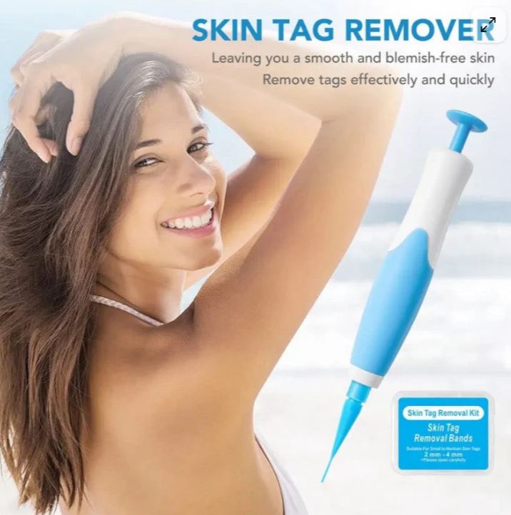Skin Tag Remover Kit